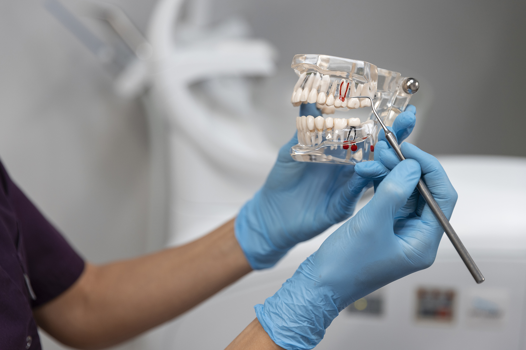 Avant de lancer un soin sur les implants dentaires, notre équipe du Centre Dentaire Cousineau à Brossard vous partage son expertise.